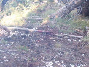 Bear Attack Survivor