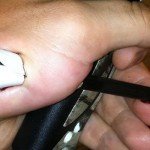 Archery_Accident