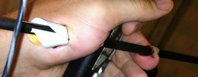Arrow shot through the hand